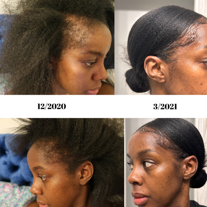 Hair oil